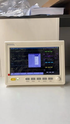 구급차 장비 의료기기 ECG NIBP 환자 모니터 병원용