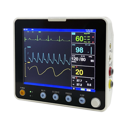 ECG ICU 다중 매개변수 환자 휴대용 모니터 병원 장비 선택 사양 ETCO2 동물 버전