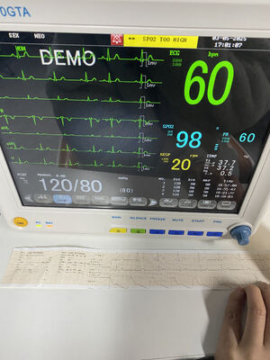 ECG SPO2 NIBP TEMP RESP 옵션이 포함된 휴대용 침대 옆 모니터 ETCO2 클래스 II 1년 보증